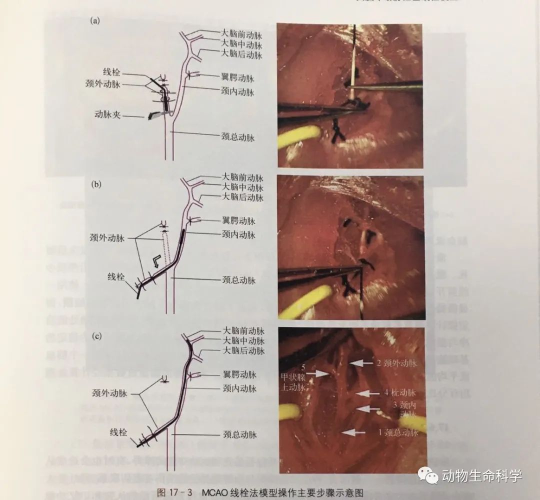MCAO线栓法模型操作主要步骤示意图
