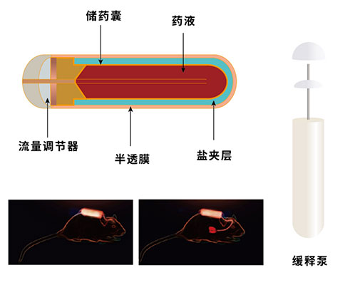瑞沃德植入式缓释泵