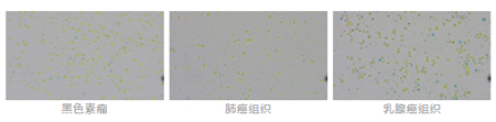 快速上手高质量肿瘤样本单细胞悬液制备