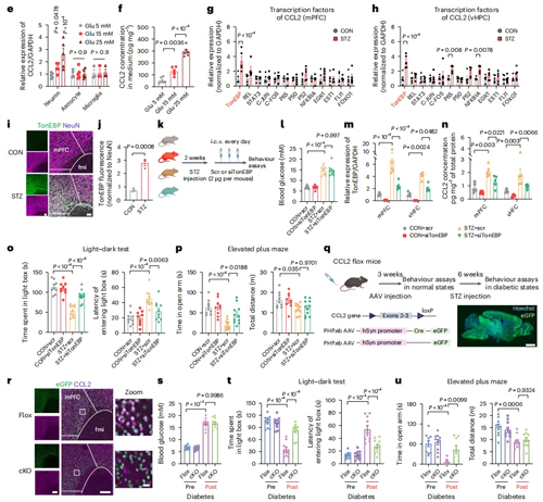 高血糖激活神经元CCL2表达导致糖尿病相关焦虑障碍