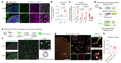 高血糖激活神经元CCL2表达导致糖尿病相关焦虑障碍